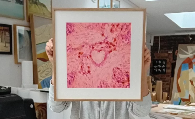 Polish Artist Captures Her Cancer Cells in Award-Winning Heart-Shaped Microphoto